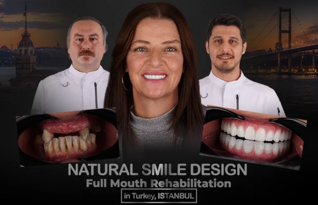 Natural Smile Design with Full Mouth Rehabilitation in Turkey, Istanbul