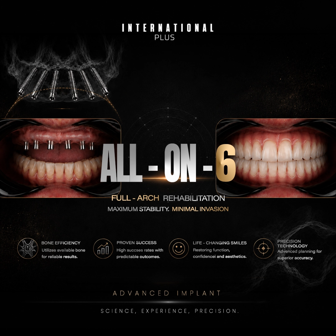The First 3 Months What Happens During Early-Stage Osseointegration
