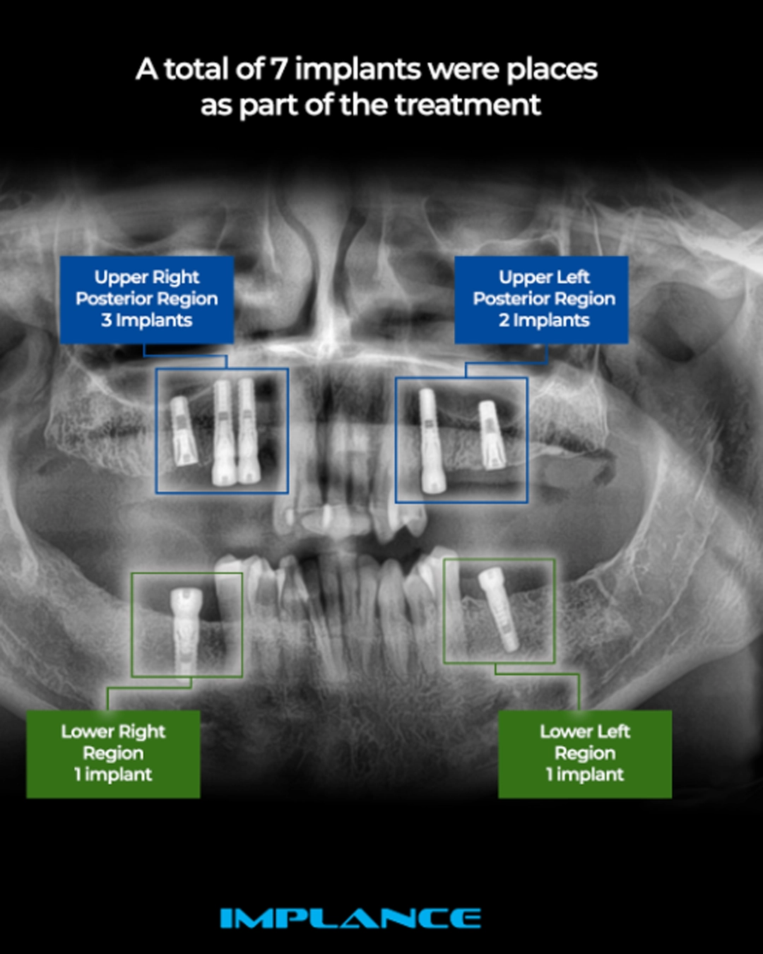 The Hidden Disease Phenomenon Why Cosmetic Consultations Require Comprehensive Evaluation