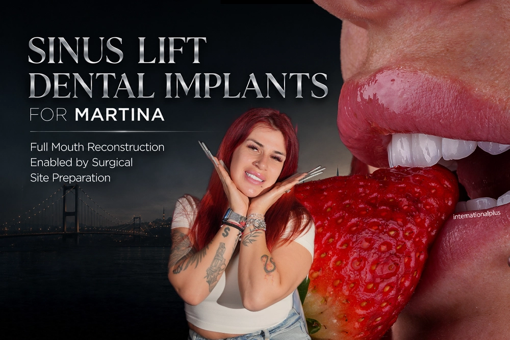 Sinus Lift Dental Implants: Martina’s Full Mouth Case