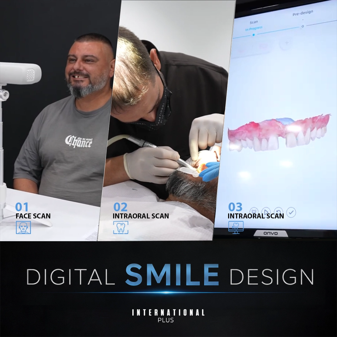 2D Photo, 3D Design or Mock Up Which Smile Simulation Should You Trust