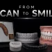 3D Smile Design How a Digital Design Becomes a Real Restoration