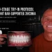 A Two Stage Try In Protocol for Wolfgang Post and Core Abutments Beneath a 24 Unit Bar Supported Zirconia Rehabilitation