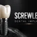 Screwless Dental Implants Cement-Retained and One-Piece Options Explained