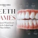 Teeth Names Explained What Every Tooth Is Called and What It Does