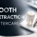 Tooth Extraction Aftercare A Day by Day Recovery Guide
