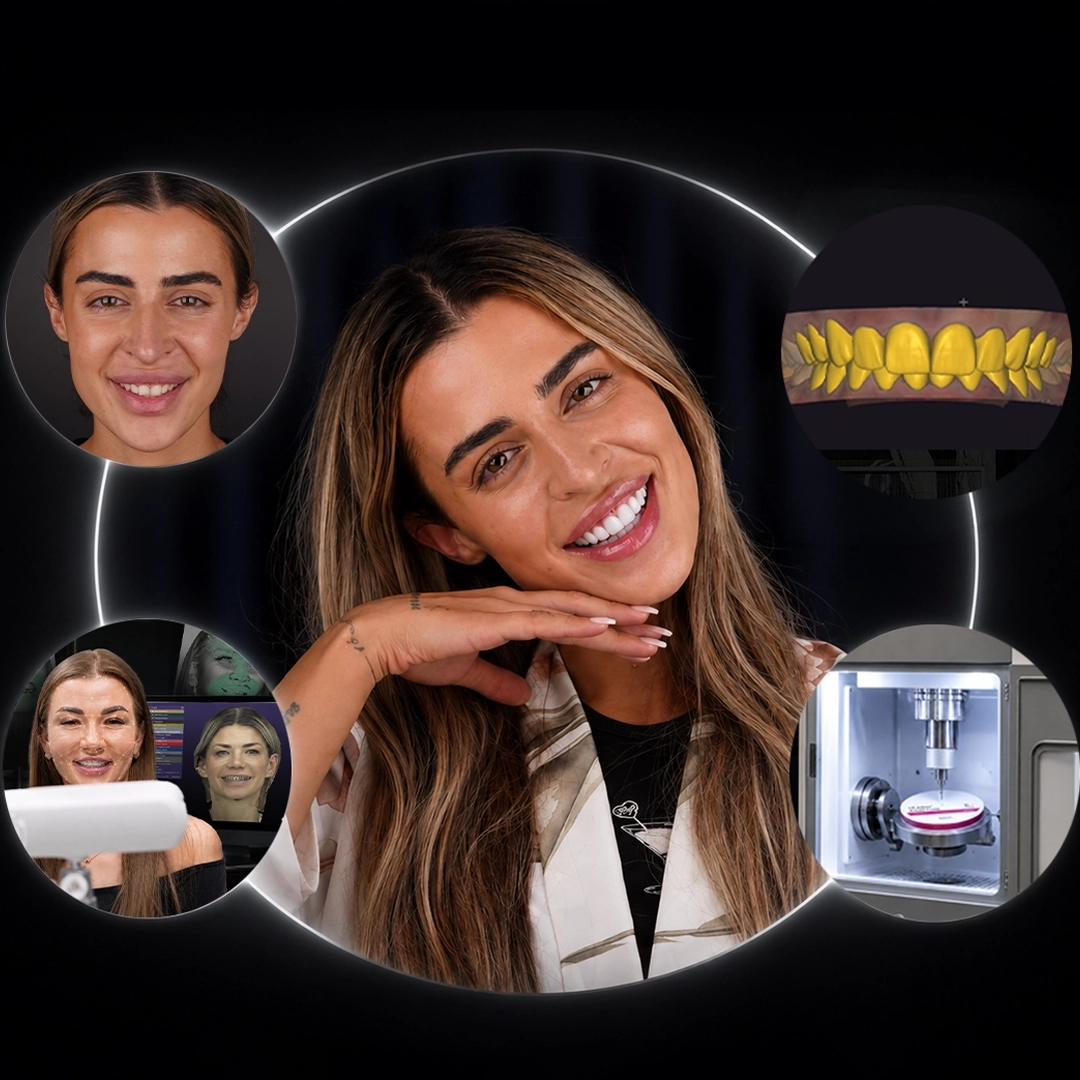 What Is 3D Smile Design and Which Data Does the Design Need