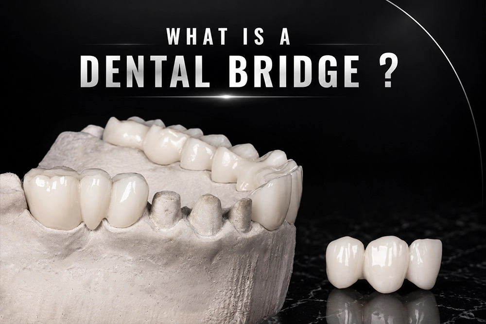 What Is a Dental Bridge and How Does It Fill the Gap of a Missing Tooth?