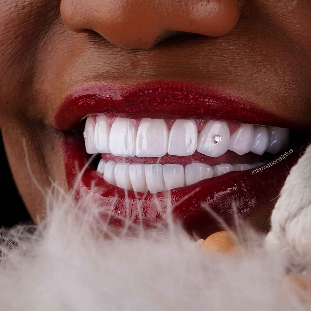 Where Does Gingivectomy Stop and Bone Surgery Begin