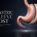 Gastric Sleeve Cost The Components That Decide Any Quote