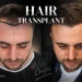 Hair Transplant Before and After What the Timeline Really Looks Like