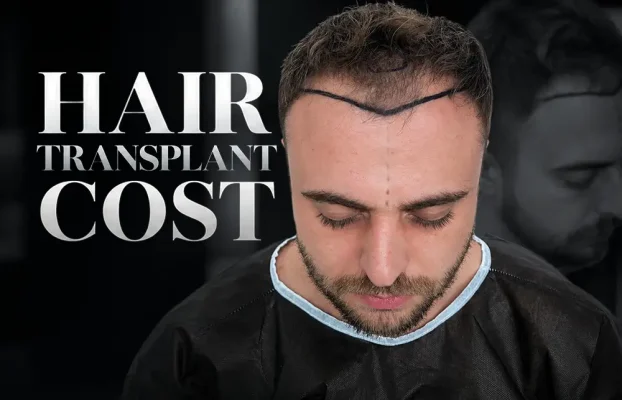 Hair Transplant Cost: What Really Drives the Price