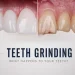 Teeth Grinding (Bruxism) Causes, Effects and How to Stop It