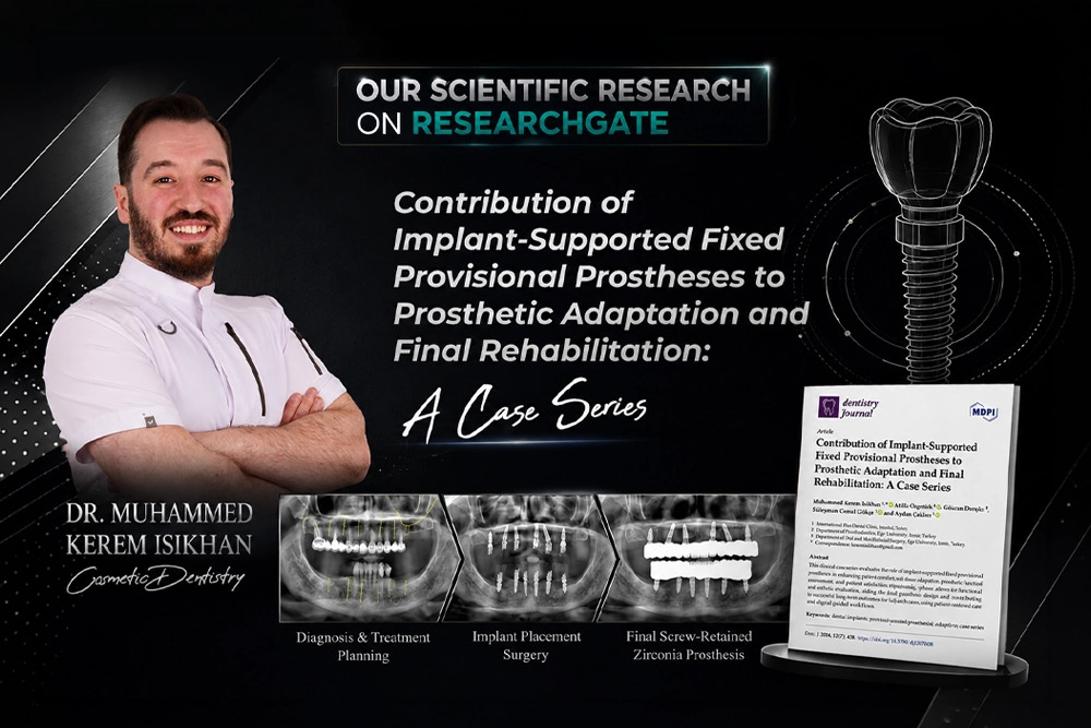 Implant-supported fixed provisional prostheses case series